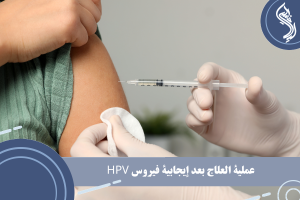 عملية العلاج بعد إيجابية فيروس HPV